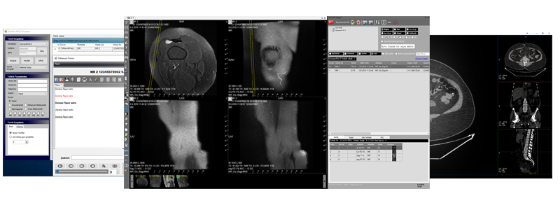 Teleradiology